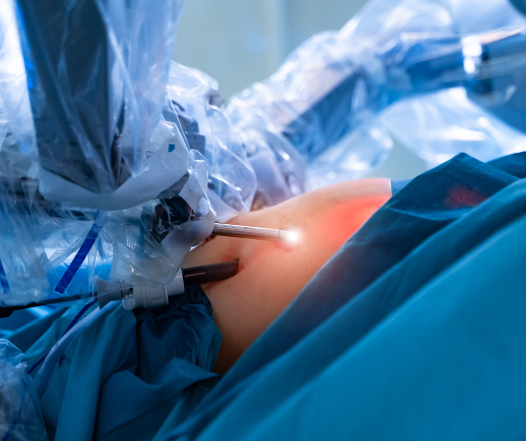 Robot da Vinci w trakcie operacji